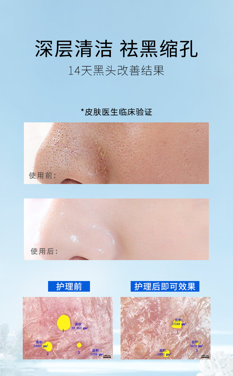 洛語(yǔ)杭希-寡肽小氣泡_06.jpg