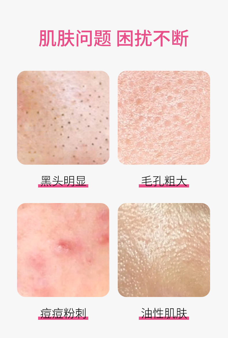 壬二酸+水楊酸細(xì)致毛孔霜-_03.jpg