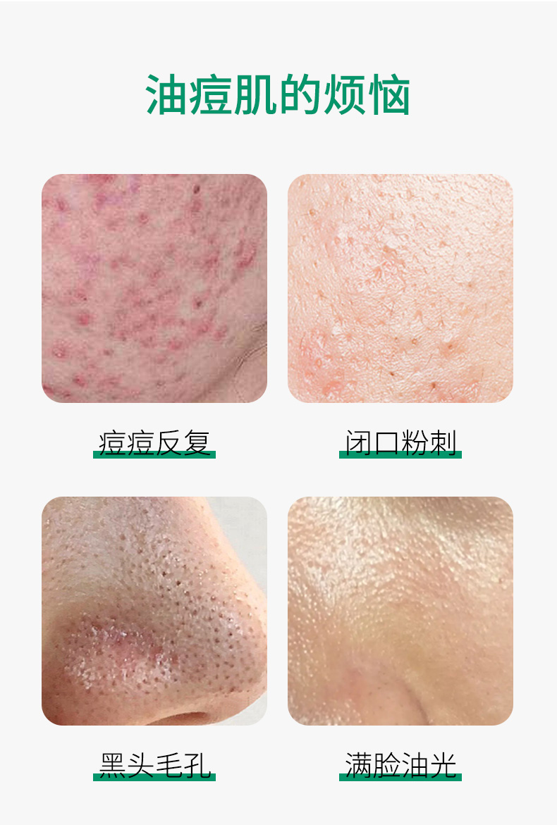壬二酸+水楊酸細(xì)致毛孔霜-_08.jpg