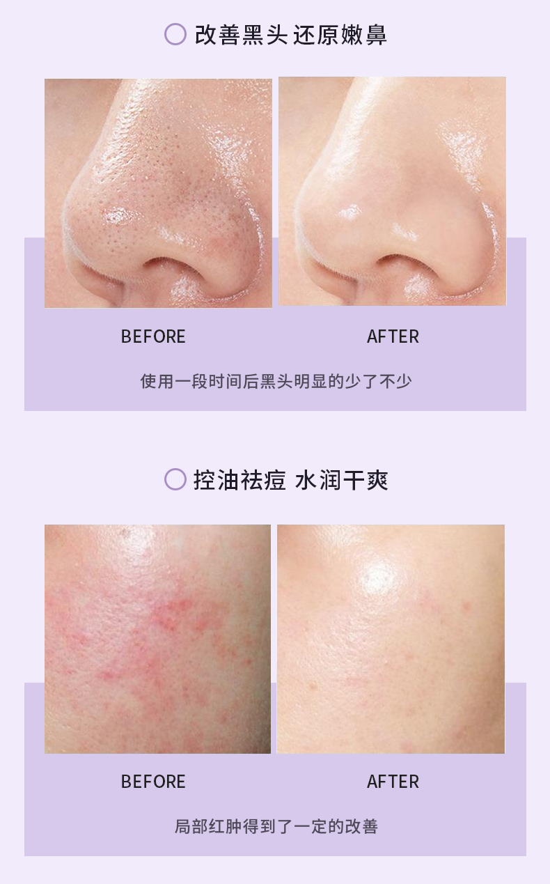 清肌凈顏泥膜棒_12.png